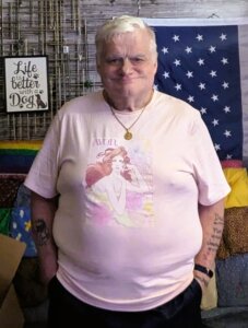 LooseSkin4U Weight Loss Journey  6. fénykép