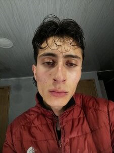 Public de Ithan_Skin  2 Imagens