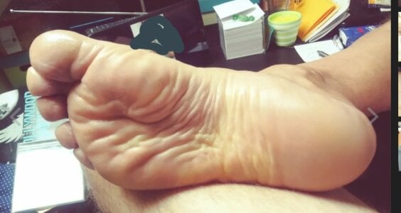 Vorhautschwanz Fuss Sohle Pic 3