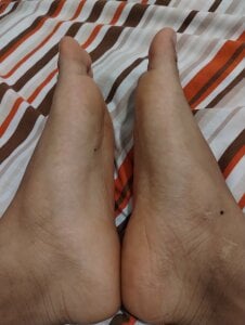 Engel420 FEET 👣❤️ Pic 2