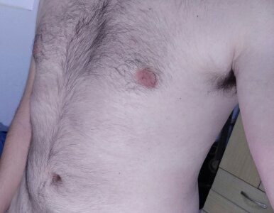 heterostop Public Pic