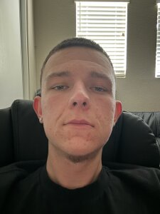 thickcock17cm Public Pic 4