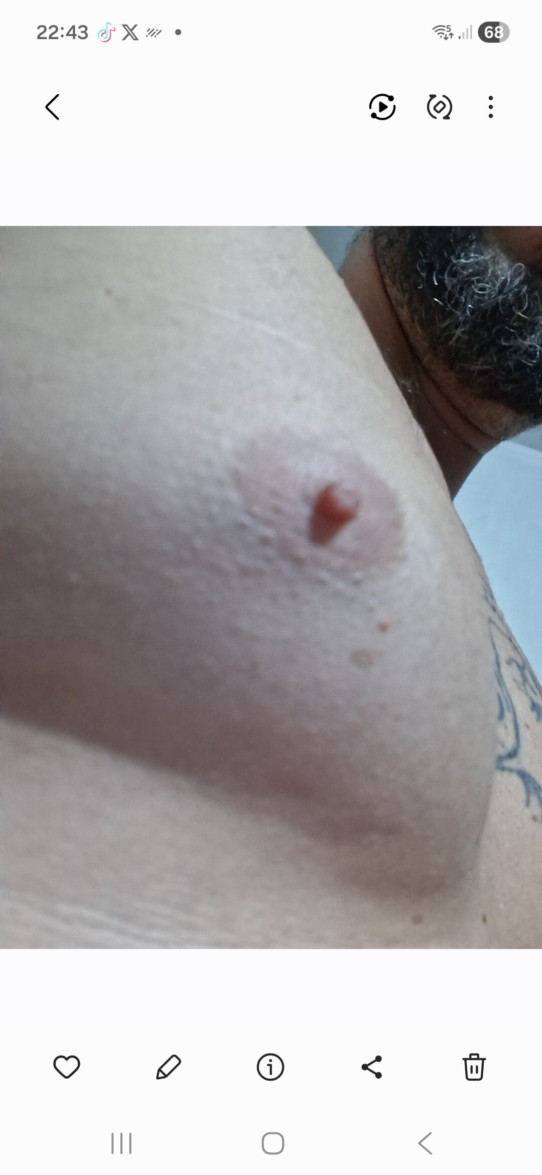 atilaportugalcasado Populära bilder 2920