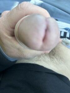 enormebitedu31 Public Billede 4