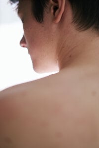 Allert_ Just me😊 fotografija 6