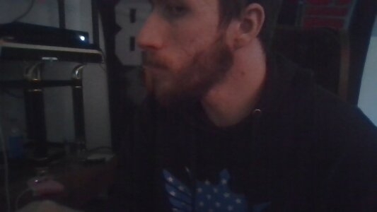 BalticPallor Public Pic