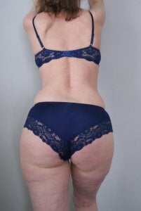 Public de Valinella  Imagens