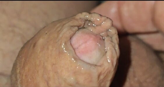 jhonschen's Tubo in silicone nell'uretra Sex Photo 3