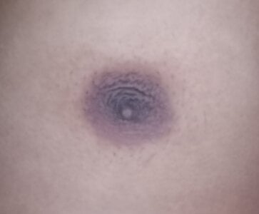 InformalFort8 Someone lich my body Pic