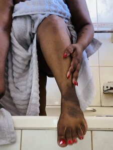 ebonylimper Public Hình 3