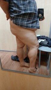 DetChompy Public Pic