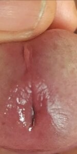 jhonschen's Che bel primo piano..... Sex Photo 3