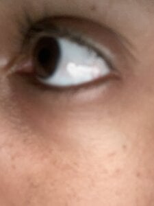 pauzudomoreno1 Eyes Pic 3