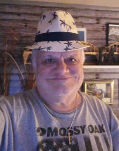 LooseSkin4U Weight Loss Journey  9. fénykép