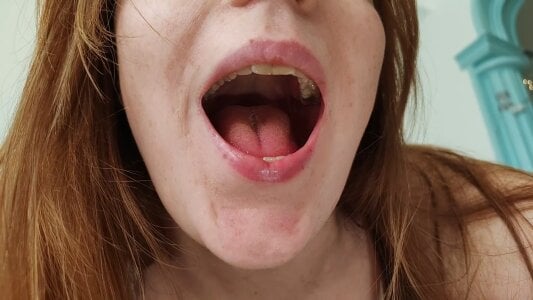 FENIX_ZLA FETISH: teeth Pic 4