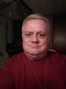 LooseSkin4U Weight Loss Journey  4. fénykép