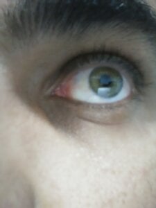 Rot19 Public Immagine  3