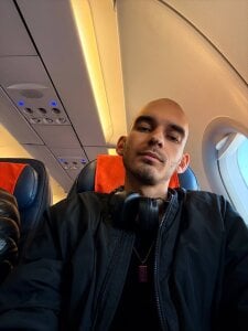 Burning_bald Public Pic 4