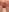 Hoa_Bimup Butt batt Pic 2