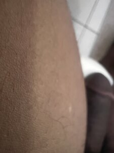 BlabbedMonkfish Public Pic 2