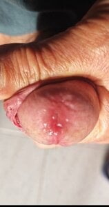 jhonschen's Gli tappo la bocca Sex Photo 3