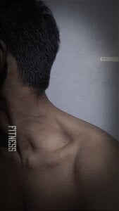 Long-termMarble56 Public Pic 7