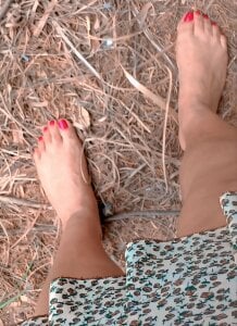 AuroraChest Public Pic