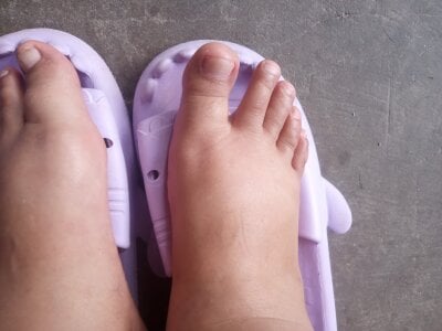 Pies de Ava89  2 Imagens