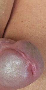 jhonschen's Che bel primo piano..... Sex Photo 1