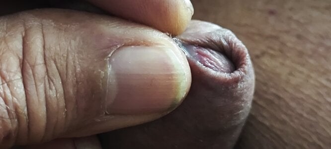 jhonschen's XXX Nude Photo 6