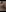 CandyShoopp: pussy close-up ( фото)