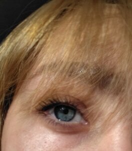 JoettaCampas Aesthetic Foto