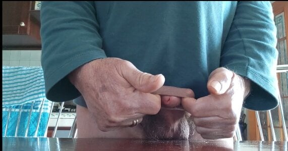 jhonschen's Allargamento prepuzio da 2 cm Sex Photo 9