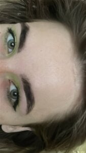 MerlinMeyer 🥰🥰🥰 Pic 2