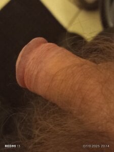 FuggySkoplje Public Pic 6