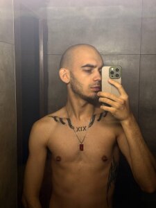 Burning_bald Public Pic 3