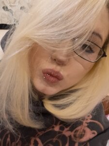 StellaZeolla after the hospital Pic 4