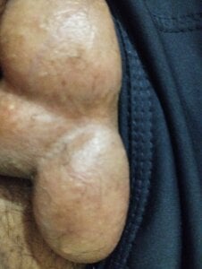 ROKSS555 Public Pic 2