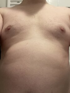 vorhauttree Körper Pic 2