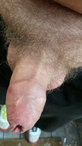 Joeangus87 Willy pics Pic 7