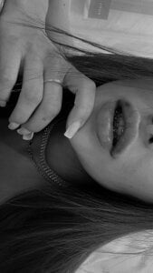 Lillie_Miller Braces Hình 2