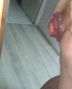 FistHot93 ASS Rose รูป 