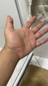 lukkerstrike Public Billede