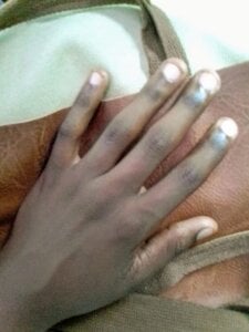 InfamousPeanut518 Public Pic 2