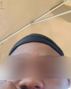 Eggxplant Public Pic 4