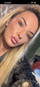 Cherrybomb2885Public Bild 3