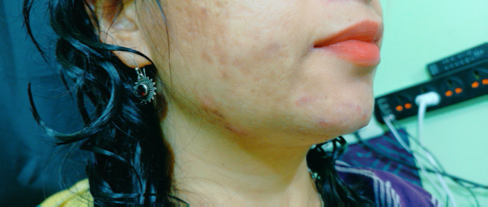 Public od Niha_kannada  2 snímek