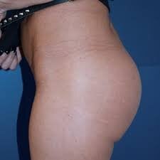 Zdjęcia spantikokokokoko Public: 