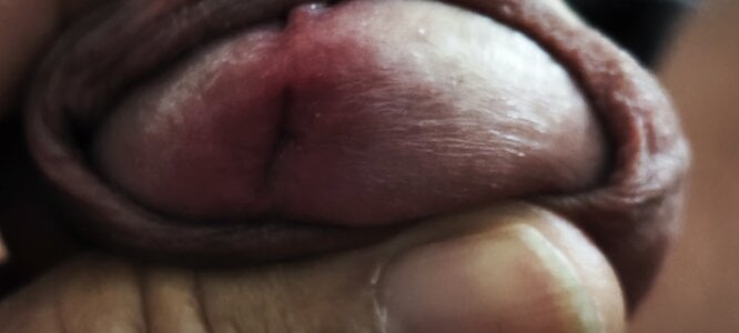 jhonschen's XXX Nude Photo 2