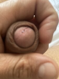 Titolino_ Public Pic